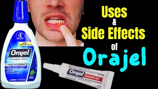 Orajel – Side Effects Uses Mechanism of Action Dosage Interactions Warnings [upl. by Cardwell860]