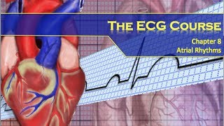 The ECG Course  Atrial Rhythms [upl. by Derraj98]