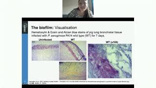 Biofilm infection in an ex vivo model of cystic fibrosis lung infection [upl. by Annahsad709]