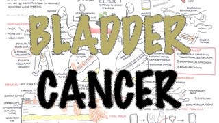 Bladder Cancer  Overview types pathophysiology diagnosis treatment [upl. by Iek333]