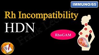 Rh Incompatibility Hemolytic Disease of the Newborn Erythroblastosis fetalis FLImmuno65 [upl. by Gable]