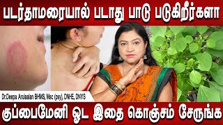 Knee Pain Causes Treatments  Home Remedies  Tamil Health Tips [upl. by Tillo]