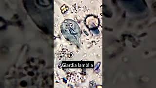 Giardia lambliaGiardiasis parasiteparasite under microscope microscopy parasitology [upl. by Simpkins]