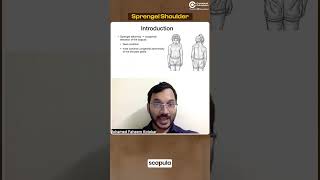 A Small overview of Sprengel Shoulder by Dr Faheem Kotekar [upl. by Nitsirhc194]