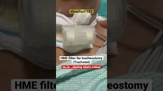 icushort 122 HME filter for tracheostomy Trachvent esbicm [upl. by Chemash]