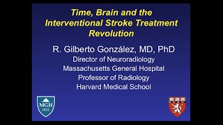 SIRRFS Webinar 82015 Time Brain and the Interventional Stroke Treatment Revolution [upl. by Havens]