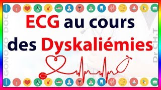 ECG au cours des dyskaliémies [upl. by Assirod322]