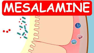 Mesalamine Pentasa ER capsules for ulcerative colitis [upl. by Namra]