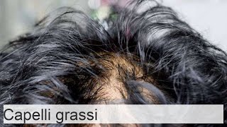 Capelli grassi e pelle del cuoio capelluto soluzioni efficaci [upl. by Etnasa]