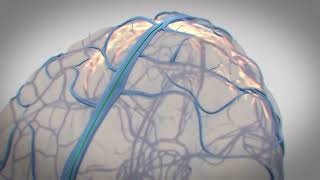 Synchron Announces Positive Results from US COMMAND Study of Endovascular BrainComputer Interface [upl. by Arodal]