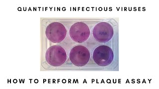 How to Perform a Plaque Assay [upl. by Myrlene]