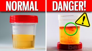 The Color Of Your Pee Says THIS About Your Health [upl. by Tarah]