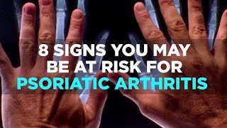 8 Signs You May be at Risk for Psoriatic Arthritis [upl. by Able]