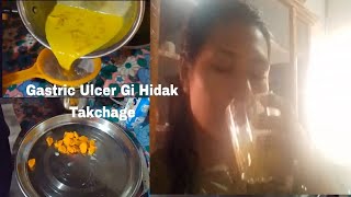 Gastric Ulcergi Kanaba Hidak Takcharake  Home remedies  Ayurvedic Cachar Monika [upl. by Victoria]