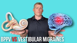 BPPV Vertigo VS Vestibular Migraine [upl. by Babita124]