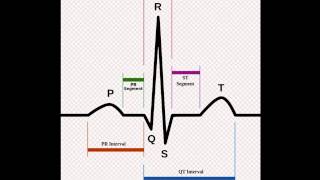 ECG Made Easy  T waves [upl. by Irpac]