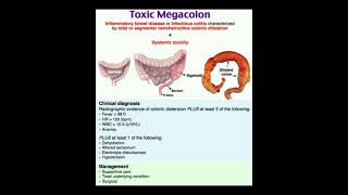 Toxic megacolon [upl. by Struve132]