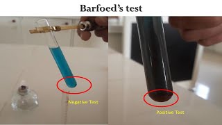 Barfoeds Test [upl. by Cusack]