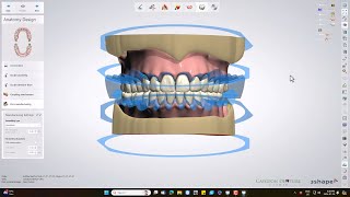 Ivotion Monolithic Denture Design [upl. by Kal]