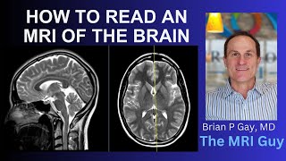 How to read an MRI of the brain  First Look MRI [upl. by Etka]