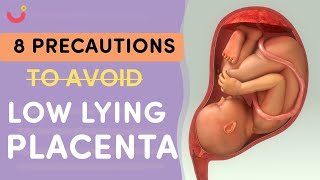 Unlock the Secrets to a Healthy Pregnancy How to Cure Low Lying Placenta Naturally [upl. by Acinoj]