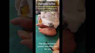 Babinski Reflex in newborn [upl. by Norling]