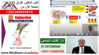 Diabetes Mellitus 1 Introduction cme internalmedicine medical usmle محاضراتباطنة [upl. by Ambler]