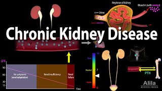 Chronic Kidney Disease Animation [upl. by Halonna]