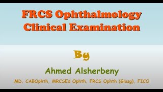 Clinical Ocular Examination  Part 2 Pupil Examination Part 2 amp Confrontation Test [upl. by Granthem574]