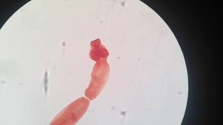 Hydatid Cyst life cycle  Echinococcus Granulosus  Hydatid disease microbiology  Dog Tapeworm [upl. by Arand]