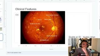 Diabetic Retinopathy MBBS Hindi 10 Marks [upl. by Remsen976]