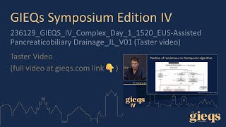 Complex Day 1 EUSAssisted Pancreaticobiliary Drainage Taster video [upl. by Oralie]