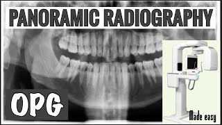 PANORAMIC RADIOGRAPHY II OPG II EXTRAORAL RADIOGRAPHY II ORAL RADIOLOGY [upl. by Aidaas]