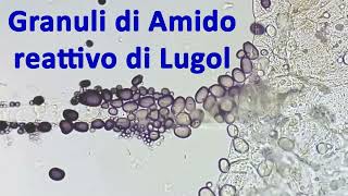 Amido e reattivo di Lugol  reazione dei granuli osservata al microscopio 🔬 [upl. by Yenobe977]