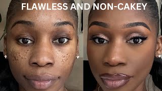 PITTED ACNE SCAR MAKEUP TUTORIAL STEP BY STEP ICEPICK SCARSBOXCAR SCARSCRATERS [upl. by Prouty]