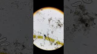 Pantoffeltierchen machen sich einen schönen Tag  Paramecium unter dem Mikroskop wissenschaft mikr [upl. by Iddo]