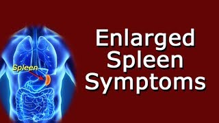 Enlarged Spleen Symptoms [upl. by Cirala679]