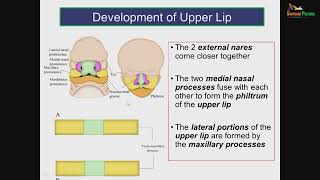 Development of face amp palate [upl. by Akeimahs]