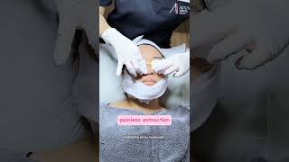 Salicylic Acid Peel For Acne Skin [upl. by Tricia]