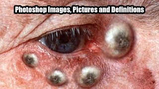 DPOW DPOWs DPOW What is a Dilated Pore of Winer WARNING Photoshop Thumbnail [upl. by Egduj672]