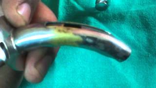 fullers bivalved metallic tracheostomy tube [upl. by Anilef]