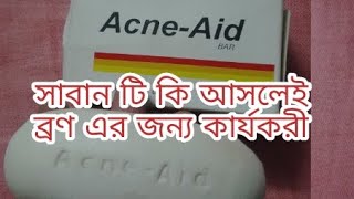 Acne aid soap bar review [upl. by Xenos792]