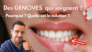 Explication GENCIVE qui SAIGNE  la solution [upl. by Susy]