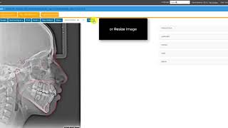 CephX  Editing Cephalometric Tracing [upl. by Zolner42]