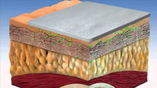 Nanobandage for Wound Healing [upl. by Phaedra]