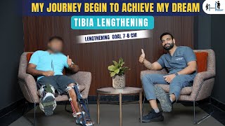 Tibia Limb Lengthening Surgery Journey for Gaining 78 cm Height  Limb lengthening Surgery [upl. by Oriel]