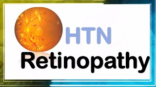 hypertensive retinopathy شرح [upl. by Beckett]