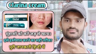 Clarina cream use benefits and Side effects full review in hindi [upl. by Baker]