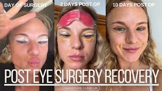 Recovery Post Eye Surgery [upl. by Kceb]