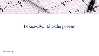 FokusEKG Blickdiagnosen Was verbirgt sich hinter dieser Videoreihe [upl. by Leith]